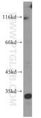 Mitochondrial carnitine/acylcarnitine carrier protein antibody, 19363-1-AP, Proteintech Group, Western Blot image 