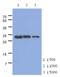 Troponin I1, Slow Skeletal Type antibody, NBP2-22621, Novus Biologicals, Western Blot image 