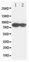 Junction Plakoglobin antibody, PA1117, Boster Biological Technology, Western Blot image 