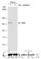 AXL Receptor Tyrosine Kinase antibody, GTX101345, GeneTex, Western Blot image 