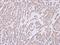 IL-12 antibody, GTX106557, GeneTex, Immunohistochemistry paraffin image 