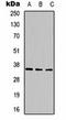 Calcium Binding Protein 2 antibody, orb323232, Biorbyt, Western Blot image 