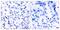 Nuclear Factor Kappa B Subunit 2 antibody, GTX50375, GeneTex, Immunohistochemistry paraffin image 