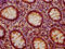 Protein Tyrosine Phosphatase Non-Receptor Type 9 antibody, LS-C681140, Lifespan Biosciences, Immunohistochemistry paraffin image 