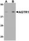 Angiotensin II type-1 receptor antibody, TA306839, Origene, Western Blot image 