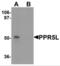 Proline Rich 5 Like antibody, NBP2-82025, Novus Biologicals, Western Blot image 