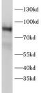Protein Kinase C Eta antibody, FNab10322, FineTest, Western Blot image 