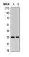 Fibroblast Growth Factor 18 antibody, orb393287, Biorbyt, Western Blot image 