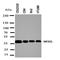 Acid Sensing Ion Channel Subunit 1 antibody, orb323217, Biorbyt, Western Blot image 