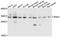 Snail Family Transcriptional Repressor 1 antibody, STJ113375, St John