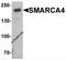 SWI/SNF Related, Matrix Associated, Actin Dependent Regulator Of Chromatin, Subfamily A, Member 4 antibody, 7749, ProSci, Western Blot image 