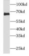 Neurofilament Light antibody, FNab05711, FineTest, Western Blot image 