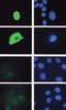 Protein Phosphatase 2 Regulatory Subunit B'Alpha antibody, orb108629, Biorbyt, Immunofluorescence image 