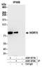 WD Repeat Domain 70 antibody, A301-870A, Bethyl Labs, Immunoprecipitation image 