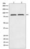 Axin 2 antibody, M01772, Boster Biological Technology, Western Blot image 