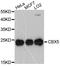 Chromobox 5 antibody, A10612, ABclonal Technology, Western Blot image 