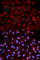 Proteasome Activator Subunit 3 antibody, A0271, ABclonal Technology, Immunofluorescence image 