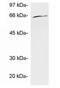 Ubiquilin 1 antibody, GTX23341, GeneTex, Western Blot image 