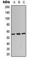 SRY-Box 9 antibody, LS-C368527, Lifespan Biosciences, Western Blot image 
