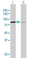 Actinin Alpha 1 antibody, LS-C196607, Lifespan Biosciences, Western Blot image 