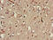 Mitogen-Activated Protein Kinase Kinase Kinase 13 antibody, LS-C678559, Lifespan Biosciences, Immunohistochemistry paraffin image 