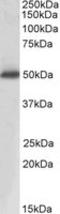 Acid Phosphatase, Prostate antibody, LS-B8309, Lifespan Biosciences, Western Blot image 