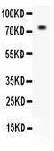 Transporter 2, ATP Binding Cassette Subfamily B Member antibody, PA2116, Boster Biological Technology, Western Blot image 