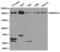 SWI/SNF Related, Matrix Associated, Actin Dependent Regulator Of Chromatin, Subfamily A, Member 4 antibody, LS-C193070, Lifespan Biosciences, Western Blot image 