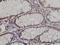 CDK5 Regulatory Subunit Associated Protein 3 antibody, H00080279-M01, Novus Biologicals, Immunohistochemistry frozen image 