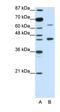 Retinoic Acid Receptor Alpha antibody, orb330113, Biorbyt, Western Blot image 