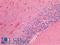Neuritin 1 antibody, LS-A12902, Lifespan Biosciences, Immunohistochemistry paraffin image 