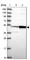 McKusick-Kaufman Syndrome antibody, HPA044233, Atlas Antibodies, Western Blot image 