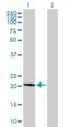 Adaptor Related Protein Complex 3 Subunit Sigma 1 antibody, H00001176-B02P, Novus Biologicals, Western Blot image 