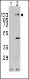 Platelet Derived Growth Factor Receptor Alpha antibody, 63-117, ProSci, Western Blot image 