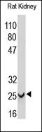 TIMP3 antibody, 251898, Abbiotec, Western Blot image 