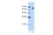 DEAD-Box Helicase 17 antibody, A01656, Boster Biological Technology, Western Blot image 