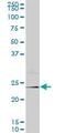 Neurogenin 1 antibody, ab89461, Abcam, Western Blot image 