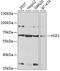 Heat Shock Transcription Factor 2 antibody, GTX54125, GeneTex, Western Blot image 