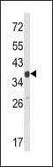 Actin Related Protein 2/3 Complex Subunit 1A antibody, PA5-35314, Invitrogen Antibodies, Western Blot image 