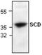 Scd2 antibody, GTX59867, GeneTex, Western Blot image 