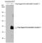 Somatostatin Receptor 1 antibody, GTX130041, GeneTex, Western Blot image 