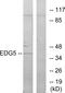 Sphingosine-1-Phosphate Receptor 2 antibody, GTX87937, GeneTex, Western Blot image 