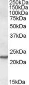 Secretion Associated Ras Related GTPase 1A antibody, MBS421631, MyBioSource, Western Blot image 