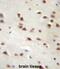 Ankyrin Repeat Domain 6 antibody, abx027160, Abbexa, Immunohistochemistry paraffin image 