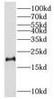 Sperm Associated Antigen 11A antibody, FNab08139, FineTest, Western Blot image 