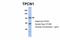 Two Pore Segment Channel 1 antibody, ARP35276_P050, Aviva Systems Biology, Western Blot image 