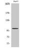 Zinc Finger ZZ-Type Containing 3 antibody, STJ96364, St John