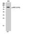 Receptor Interacting Serine/Threonine Kinase 2 antibody, STJ90957, St John