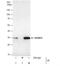 Homeobox B13 antibody, NBP2-43655, Novus Biologicals, Immunoprecipitation image 