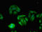 Tyrosine-protein kinase TXK antibody, LS-C679935, Lifespan Biosciences, Immunofluorescence image 